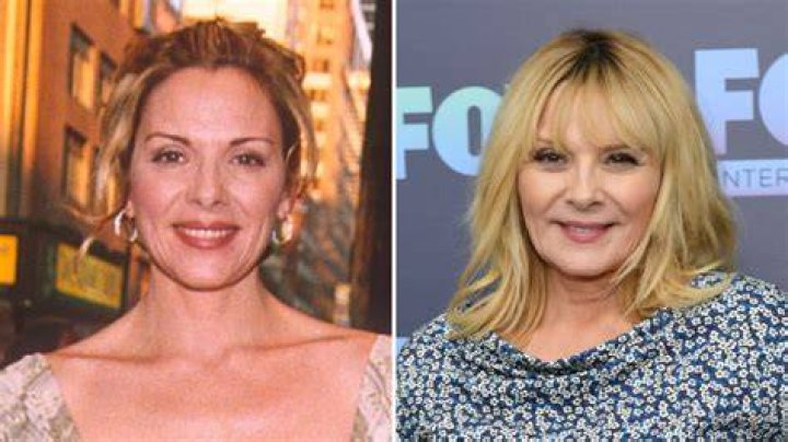 Kim Cattrall Plastic Surgery Before and After