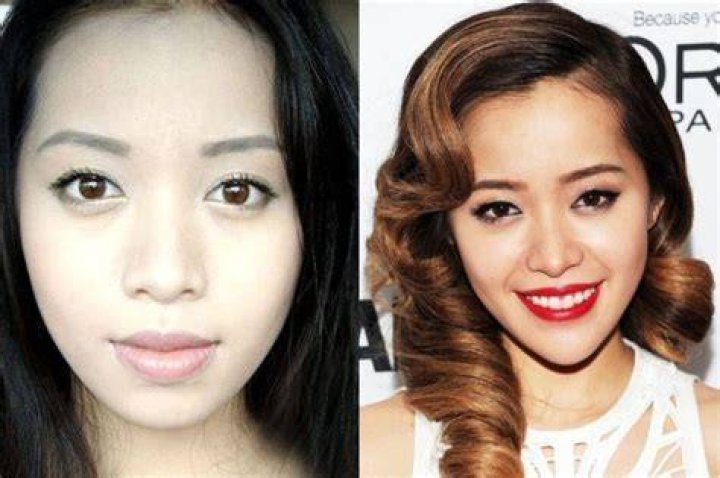 Michelle Phan Plastic Surgery Before and After