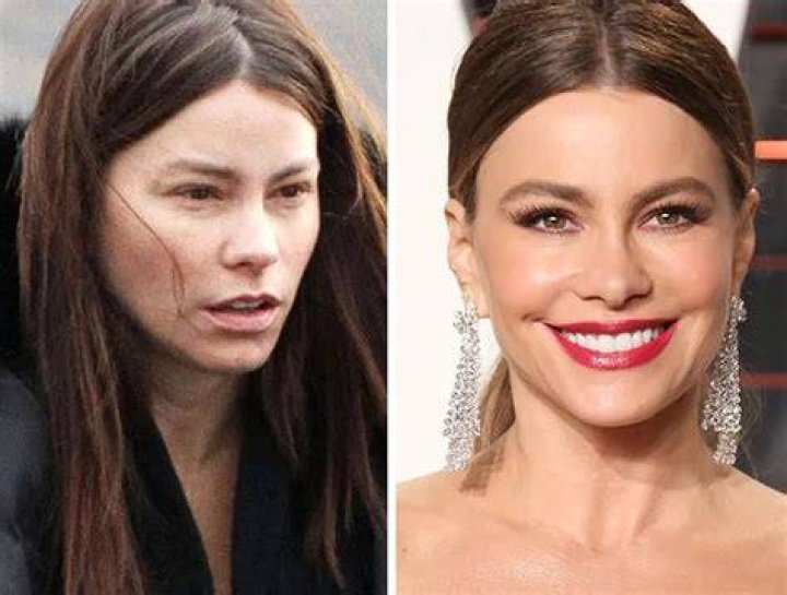 Sof&iacute;a Vergara Plastic Surgery Before and After